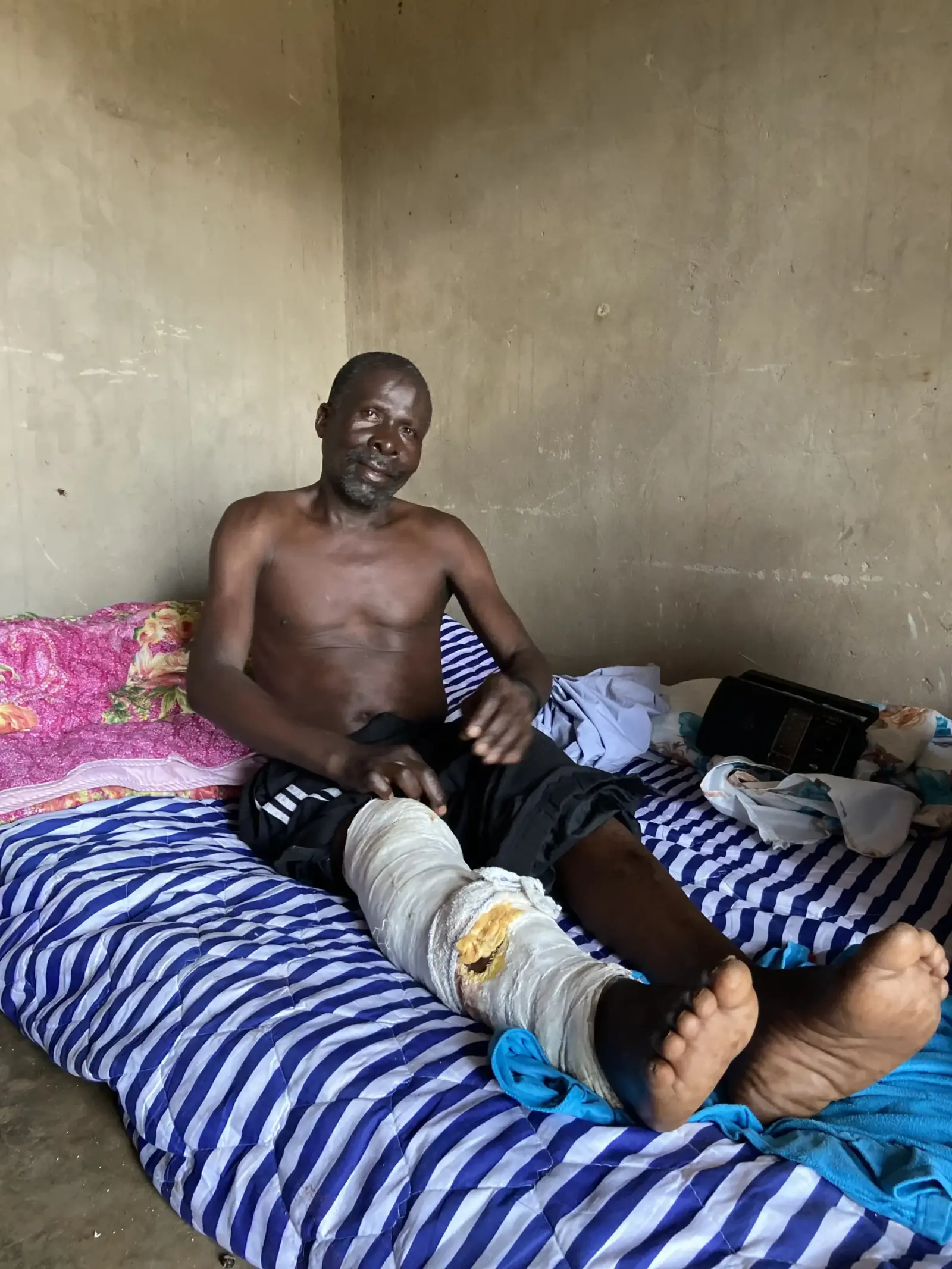A man with a bandaged leg resting on a mattress, receiving care at home